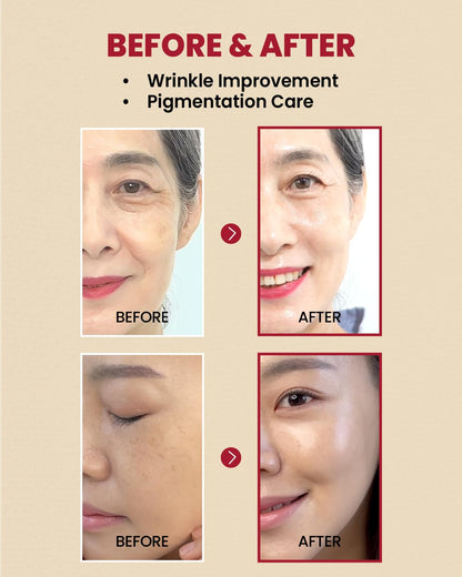KSECRET - SEOUL 1988 Serum : Retinal Liposome 2% + Black Ginseng